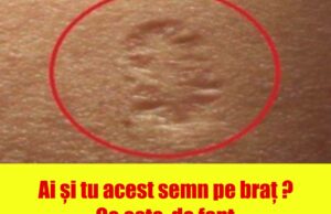 Probabil ai observat si tu ca exista anumite persoane care au o cicatrice rotunda in partea de sus a bratelor. Probabil o ai si tu