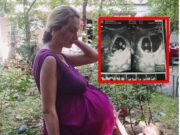 Însărcinată fiind, a mers să facă o ECOGRAFIE de rutină.