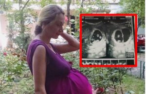 Însărcinată fiind, a mers să facă o ECOGRAFIE de rutină.