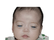 Nimeni nu a dorit-o pe această fată cu ochi de argint, până când o femeie a văzut o poză de-a ei și a schimbat totul…