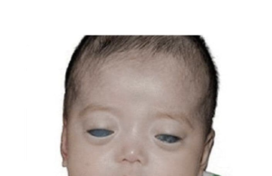 Nimeni nu a dorit-o pe această fată cu ochi de argint, până când o femeie a văzut o poză de-a ei și a schimbat totul…