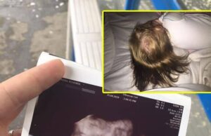 O fetiță s-a născut cu plete și avea un păr bogat încă din timpul sarcinii