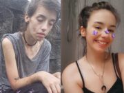 CHINURILE PRIN CARE A TRECUT O TÂNĂRĂ DE 24 DE ANI. CUM ARATĂ ACUM, DUPĂ CE A FOST DEPENDENTĂ DE DROGURI: ”AM O GAURĂ ÎN INIMĂ”