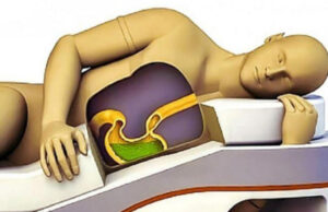 Cum sa nu dormi niciodata. Pozitii de somn care iti distrug sanatatea: