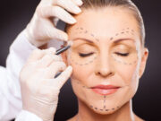 Sute de femei din București și Ilfov au apelat la serviciile lor, în special pentru injectare cu acid hialuronic în buze.