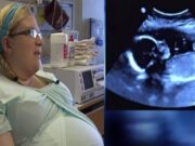 La 3 luni de la căsătorie a rămas însărcinată, dar la prima ecografie, doctorii au rămas șocați când s-au uitat la ecran: „Așa ceva se întâmplă o dată la 15 milioane de nașteri” Ce avea femeia în ea e unic, nici acum nu-i crede nimeni!..–>