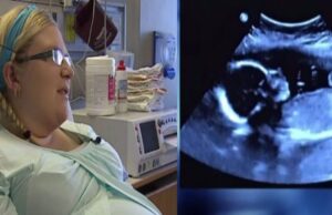 La 3 luni de la căsătorie a rămas însărcinată, dar la prima ecografie, doctorii au rămas șocați când s-au uitat la ecran: „Așa ceva se întâmplă o dată la 15 milioane de nașteri” Ce avea femeia în ea e unic, nici acum nu-i crede nimeni!..–>