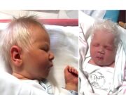 Un bebeluș s-a născut cu părul alb! Când doctorii au dezvăluit motivul, părinții au rămas fără glas!Vezi aici : ––