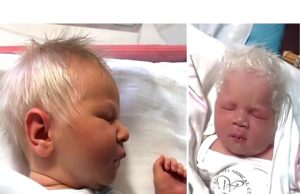 Un bebeluș s-a născut cu părul alb! Când doctorii au dezvăluit motivul, părinții au rămas fără glas!Vezi aici : ––