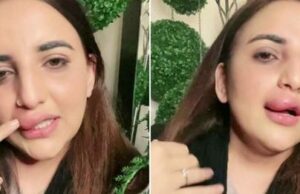 O influenceriţă, vedetă pe TikTok, susține că a rămas cu o buză umflată după ce a rămas fără bani –