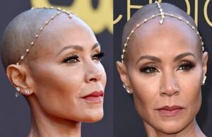 De ce boală suferă Jada Pinkett Smith, soția lui Will Smith: „A fost groaznic când a început”