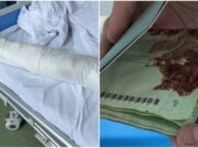 Un tânăr împușcat în Kiev a mers 5 zile pe jos pentru a ajunge în România