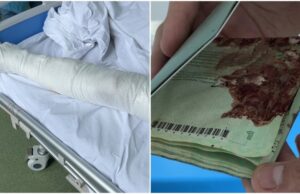 Un tânăr împușcat în Kiev a mers 5 zile pe jos pentru a ajunge în România