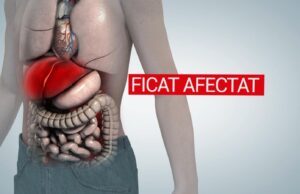 Boala de care suferă de fapt fetiţa suspectă de hepatită nouă. Va primi un ficat de la un tânăr de 17 ani