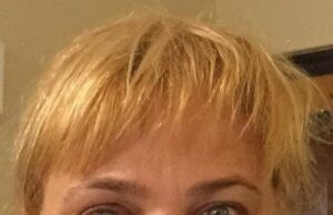 „Doctorul m-a întrebat: «Unde este tumora? Ce ai făcut cu ea?». I-am zis: «Eu vă spun ce am făcut, dar nu o să mă credeți»” A fost depistată cu cancer, cu o tumoră de 8 centimetri, dar Anca Sigartău i-a uimit și pe medici! Cum a reușit actrița să scape de boală –»