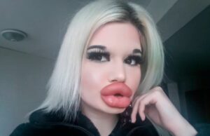 O tânără de 22 ani vrea să intre în „Cartea Recordurilor” cu cele mai mari buze din lume