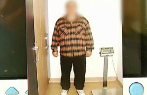 Obezitatea a devenit un fenomen îngrijorător în Europa, după pandemie. În România, 60% dintre adulți sunt supraponderali