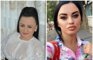 Iată câte operații estetice are Carmen de la Sălciua. Ce complexe avea artista înainte de ajunge pe mâna esteticianului