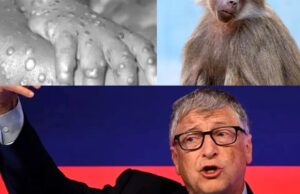 Bill Gates a prezis că va veni valul de îmbolnăviri cu variola maimuței: „Suntem gata pentru următoarea pandemie” –»