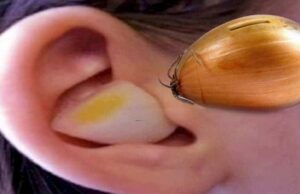 Leac din străbuni! Minune făcută de o simplă felie de ceapă așezata în ureche.