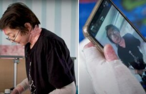 Băiatul cu „piele de fluture”: orice mișcare e un pericol pentru viața lui. Trebuia să trăiască doar trei zile, iar azi are 16 ani