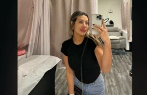 Pățania unei femei după ce și-a injectat acid hialuronic în buze. Medicii nu au mai văzut așa ceva.