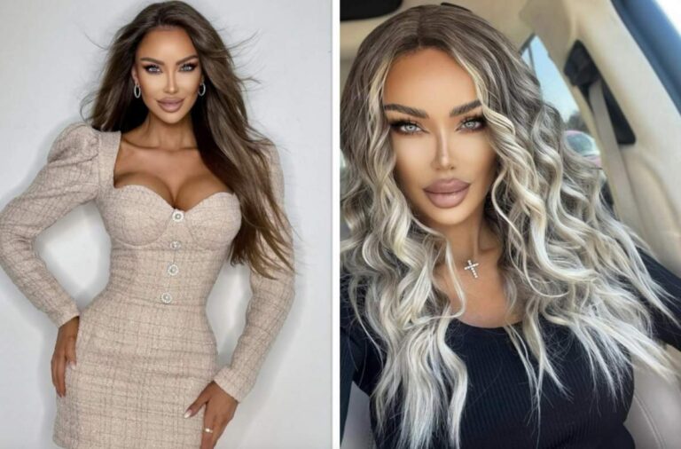 Bianca Drăgușanu și-a topit acidul hialuronic din buze! Diva a început o schimbare radicală: ”Îmi asum, că e greșeala mea”