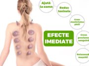 TERAPIA CU VENTUZE SI BENEFICIILE SALE