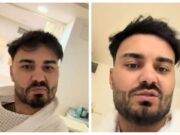 Jador, pe masa de operație! Ce intervenție va suferi manelistul: „Foarte important”