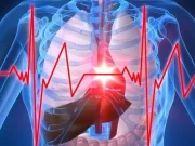 Legatura dintre apa si infarct