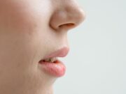 Ai o umflătură pe buză? Cum deosebești un mucocel de herpes sau furuncul și ce greșeli să NU faci