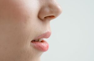 Ai o umflătură pe buză? Cum deosebești un mucocel de herpes sau furuncul și ce greșeli să NU faci